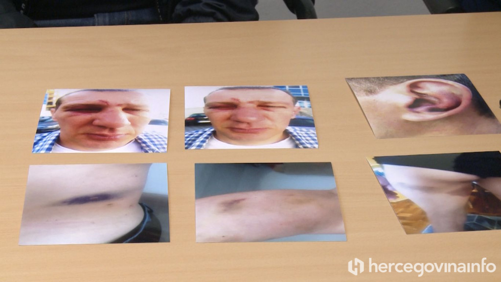 Pretučeni Trebinjac