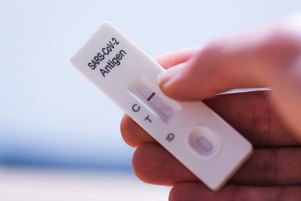 antigenski test, covid potvrda