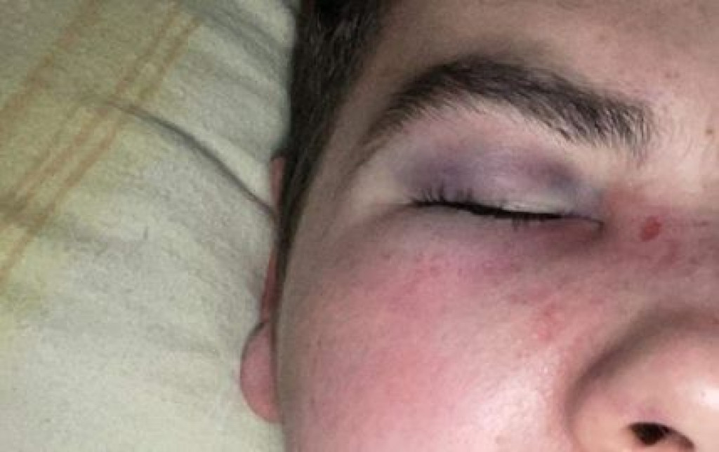 Busovača Ivan Jurišić pretučen 