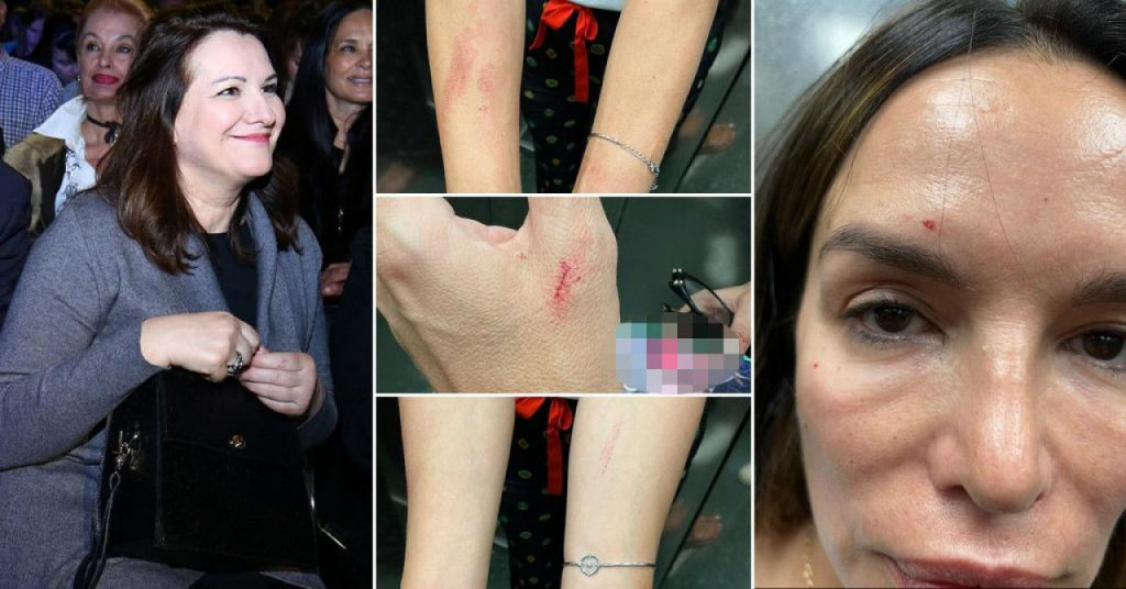 Severina,uhićenje,Severina