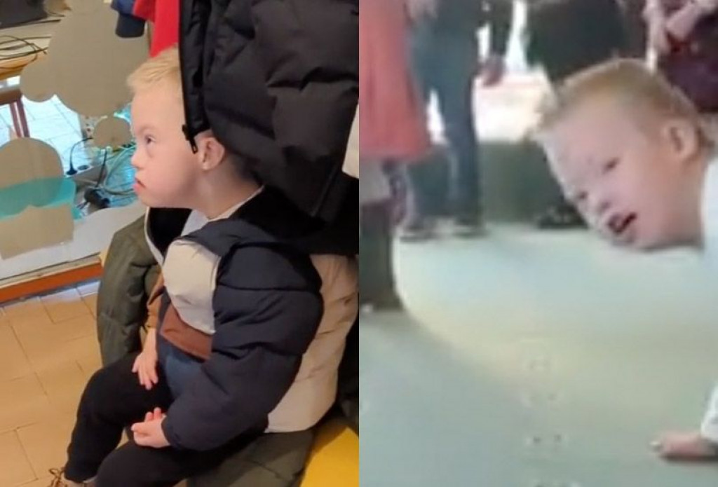 Dječak Down sindrom