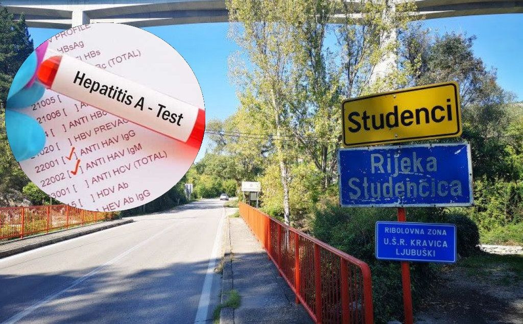 Hepatitis A Studenci
