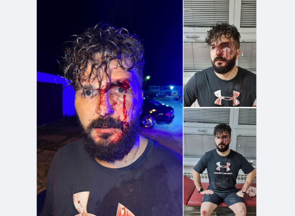 Pretučeni novinar Mirza Dervišević