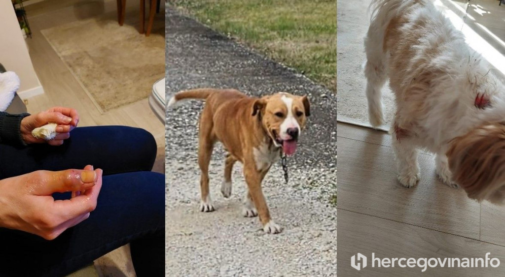 Pas u Ljubuškom izgrizao ženu i drugog psa