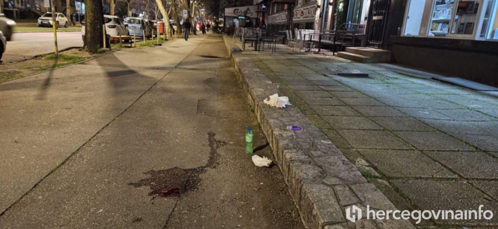 Dijete zadobilo ozljede u padu s romobila