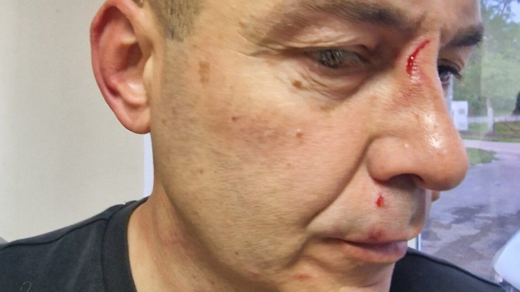 Pretučen sudac nakon utakmice