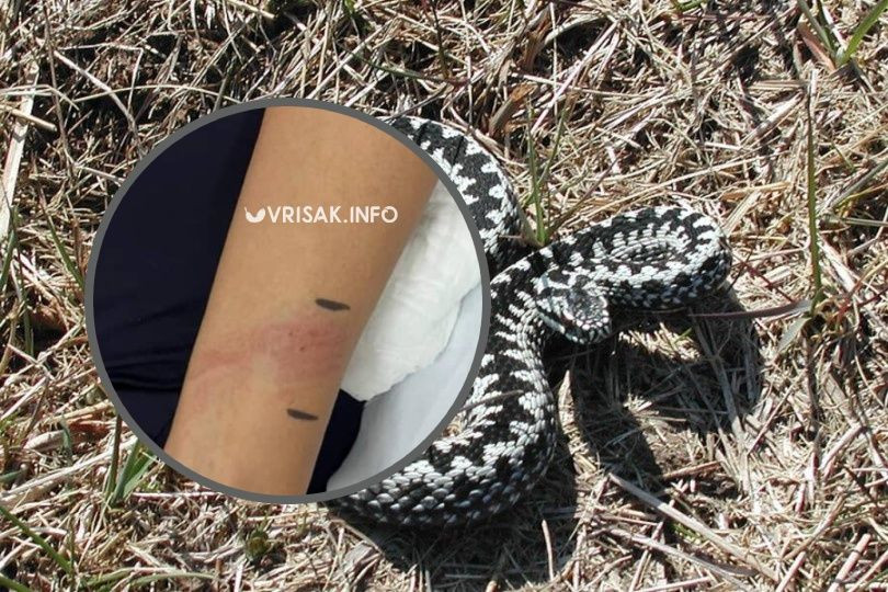 Ugriz zmije