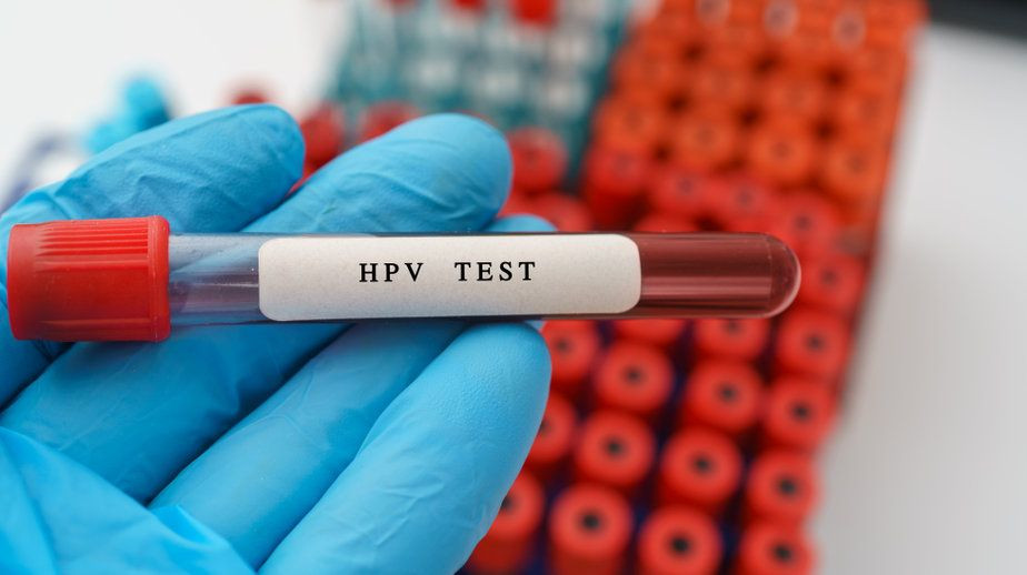Testiranje na HPV virus